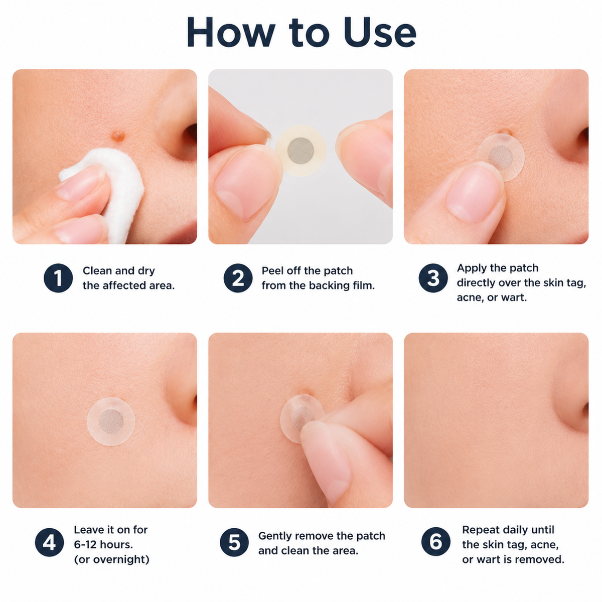 🔥 LAST DAY SALE-80% OFF ✨Curalona®2-in-1 Microneedle & Hydrocolloid Patch🍀| Removes Raised Moles, Acne, Flat Warts & Skin Tags | Helps Improve Wrinkles, Scars & Blemishes | Invisible Patches for Face & Body