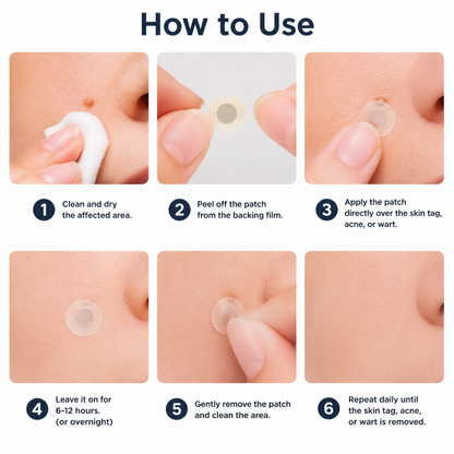 🔥 LAST DAY SALE-80% OFF ✨Curalona®2-in-1 Microneedle & Hydrocolloid Patch🍀| Removes Raised Moles, Acne, Flat Warts & Skin Tags | Helps Improve Wrinkles, Scars & Blemishes | Invisible Patches for Face & Body